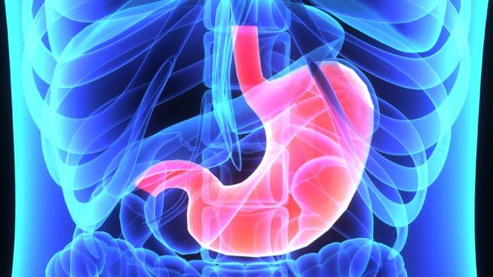 Gastric Bypass Dallas, Fort Worth