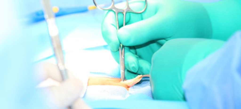 Hernia Surgery Bihar
