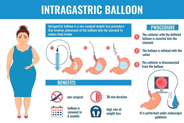 3 Non Surgical Weight Loss Procedures