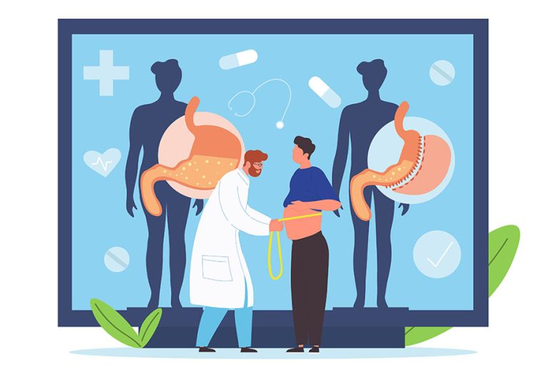 All You Need to Know About Drinking Alcohol After Gastric Sleeve