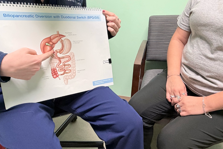 How bariatric surgery reduces stomach size