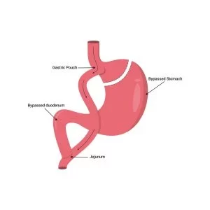 oagb-surgery-scaled-qfs3xodd8rrpg9fzeltu44mp1qjs4eztysil6p0fco